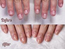 パズルリングネイル(Puzzle.ring Nail)/深爪スカルプー￥19800