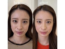 ハリノヒ 本町院/本町/肥後橋/淀屋橋徒歩10分