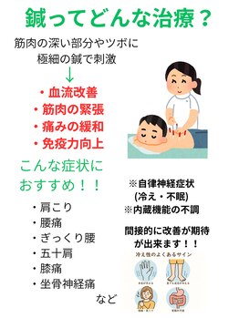 あい整体院 仙台幸町院/鍼ってどんな施術？