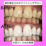 トータルビューティー エヌ プラス(total beauty n+)