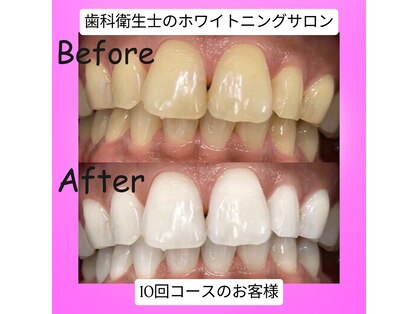 トータルビューティー エヌ プラス(total beauty n+)の写真