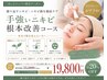 【もう繰り返さない。大人ニキビに本気で終止符】剥離ありハーブピーリング