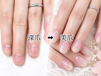 フェリーチェ 瑞江(felice)の写真/【ハンドネイルケア★甘皮すっきりウォーターケア&トップコート¥3850】深爪などお爪に悩みがある方も◎