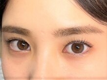 フォレスト(Forest)/