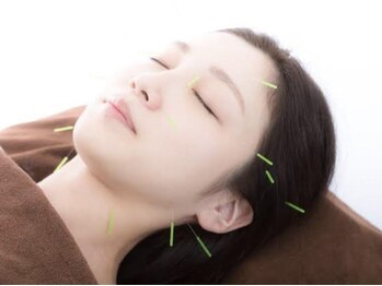 ラーナ(:ra-na)の写真/【女性に寄添う女性の為の鍼灸院】身体とお肌のお悩みにWHOも認める鍼灸で根本改善◎女性特有のお悩みにも!