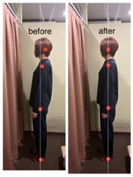 アイリー(Irie)/姿勢矯正