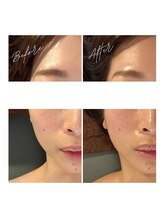 ワイビューティ(Y.Beauty)/