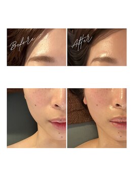 ワイビューティ(Y.Beauty)/