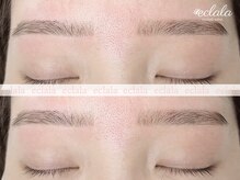 エクララ(eclala)/眉毛wax