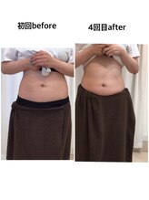 ジョワイユ(Joyeux)/腸の位置でお腹は変わる