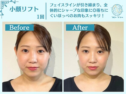 フローフシ∞の写真
