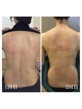 ムーン(MOON)/トーンヌール体験