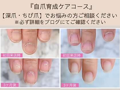 ルシェルアイの写真