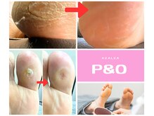 ピーアンドオー(P&O)