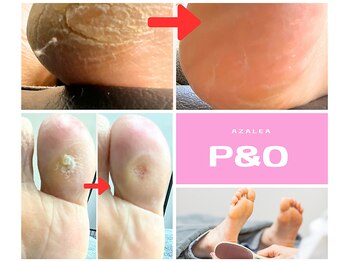 ピーアンドオー(P&O)