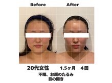 ラナン パラフューズ(Ranun's PARAFUSE.)/体重の変化がないのにスッキリ♪