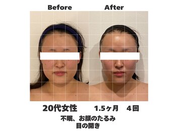 ラナン パラフューズ(Ranun's PARAFUSE.)/体重の変化がないのにスッキリ♪