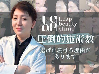 リープ(Leap)の写真