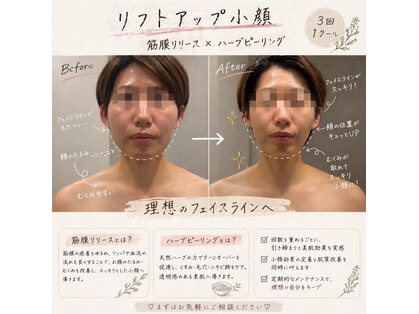 トータルビューティ リライフ(Total beauty Relife)の写真