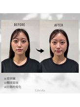 リベルタ鍼灸整骨院 なんば店(Liberta鍼灸整骨院)/仕事帰りに行けますか？
