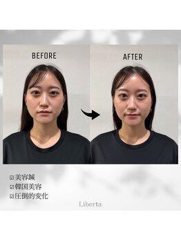 リベルタ鍼灸整骨院 なんば店(Liberta鍼灸整骨院)/仕事帰りに行けますか?