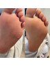 OPEN記念◯フット角質除去◯￥3,300→￥2,200