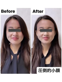 カナエル(CANAEL)の写真/「今までの小顔矯正とは違う！」痛みを最小限に抑えた頭蓋骨小顔矯正をご提供いたします◎