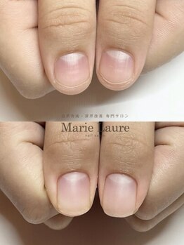 マリーロール 天王寺店(Marie Laure)/自爪育成/深爪矯正/ネイルケア