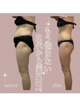 ソワン(Soin)/60代全身