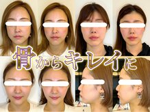 整え屋 レッド(RED)の雰囲気（ビフォーアフター/ストレッチ/阿波座/整体/小顔矯正）
