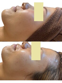 ヒーリングハーツ(Healing Hearts)/お肌のくすみケア!潤う美白