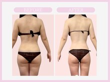 スリムライン 秋田店(The Slim Line)/before→after