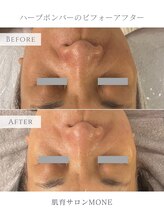 モネ オキナワ(MONE okinawa.)/くすみも