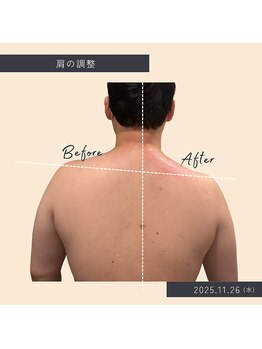 ソロウノ 平和島本院/肩の調整