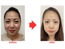 ブプラ 小倉店(BUPURA)/