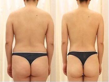 ファニービー 吹田店/マイナス8キロを叶える♪