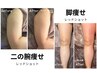 【お腹・脚・二の腕】脂肪サイズダウン/韓国発レッドショット導入/内臓ケア付