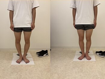 整体院がく前橋駒形院【O脚X脚/骨盤矯正/整体】の写真/通いやすさ重視の方におすすめ◎プロの技術をリーズナブルに体験できる、お得なメニューをご用意♪