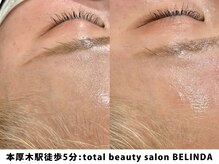 ベリンダ(BELINDA)/毛穴洗浄×フェイスワックス