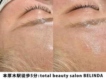 ベリンダ(BELINDA)/毛穴洗浄×フェイスワックス