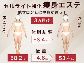 ラ パルレ 梅田本店/全身引き締めセルライトケア