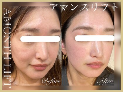 ミリュール(Millule)の写真