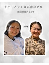 シナジェ 並木通り店(Synergye)/店長自ら変化を体験♪