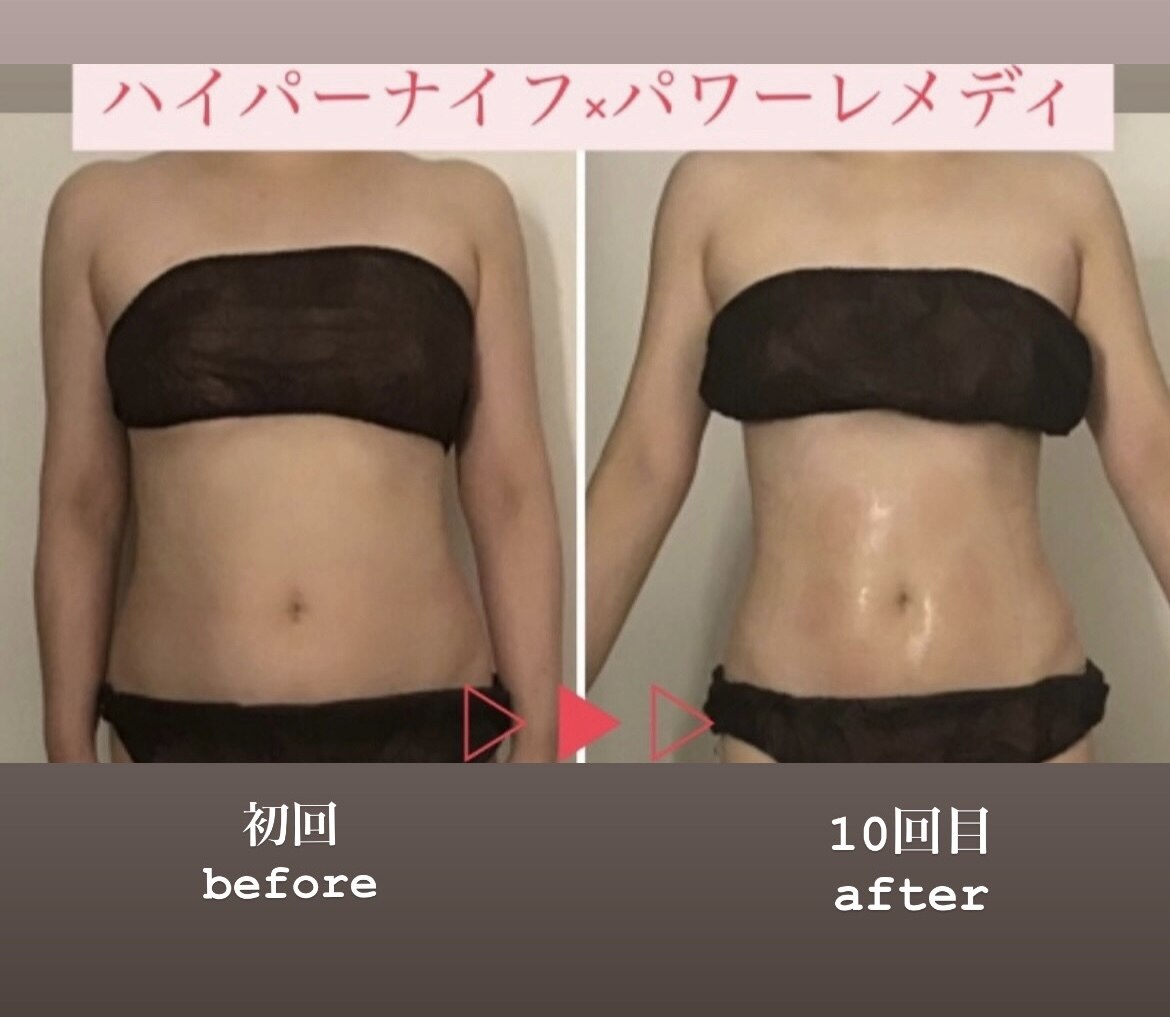 ベルフィーヌ(BELLEFINE)｜ホットペッパービューティー