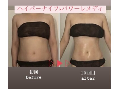 ベルフィーヌ(BELLEFINE)の写真