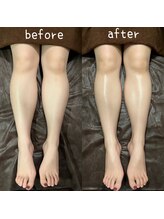 エルア(2 elua)/半身アロマリンパ（下半身）