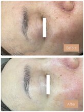 FJ/お肌のハリ◇艶