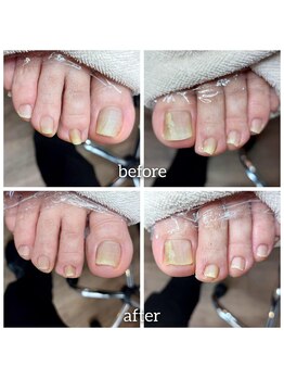 爪切り屋 足楽/