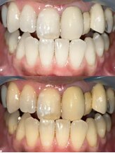 アルクローゼット(aru closet)