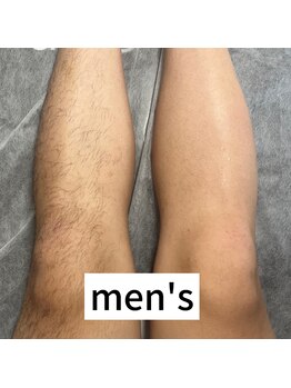 ホームプラスワクシング(Home＋waxing)/メンズWAX